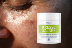 Provilea Kressesalbe im Test